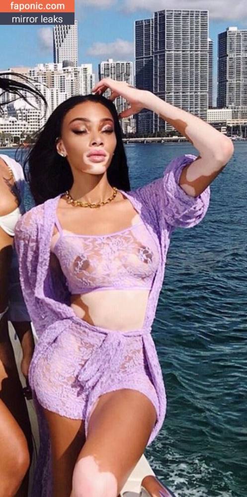 Winnie Harlow aka winnieharlow Nude Leaks - #12