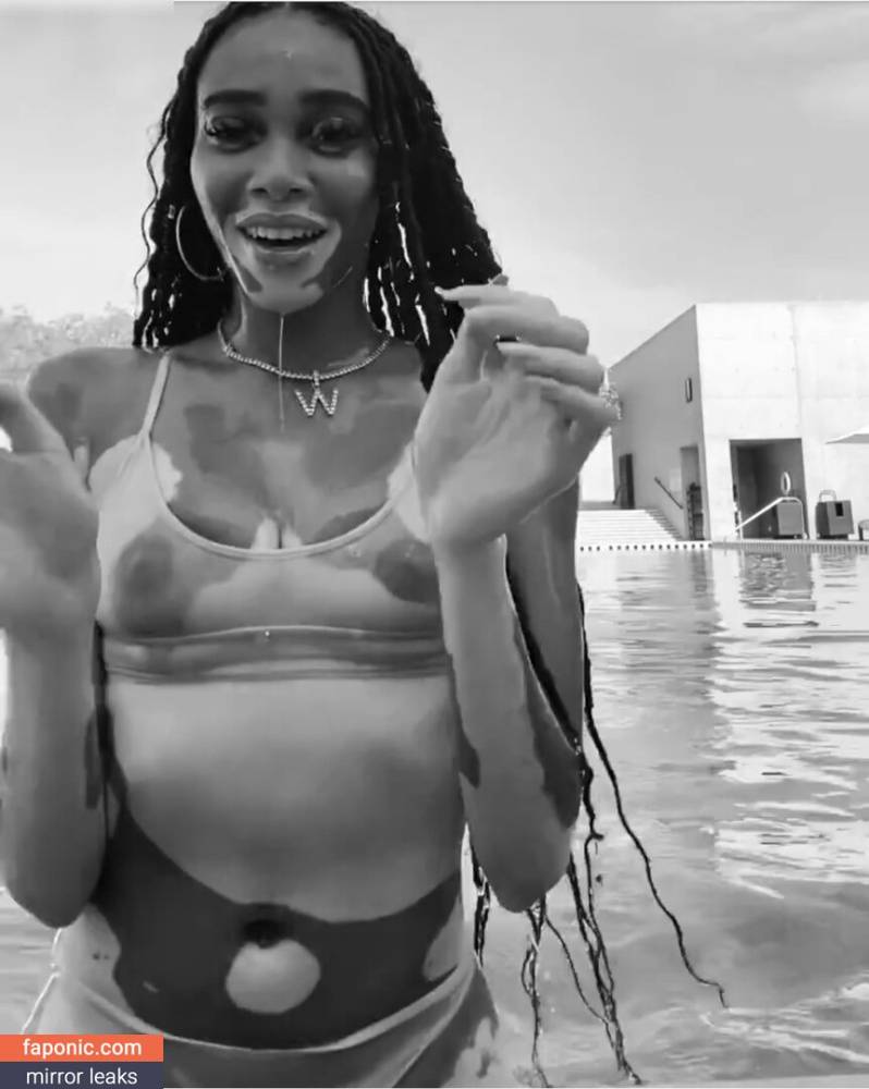 Winnie Harlow aka winnieharlow Nude Leaks - #2