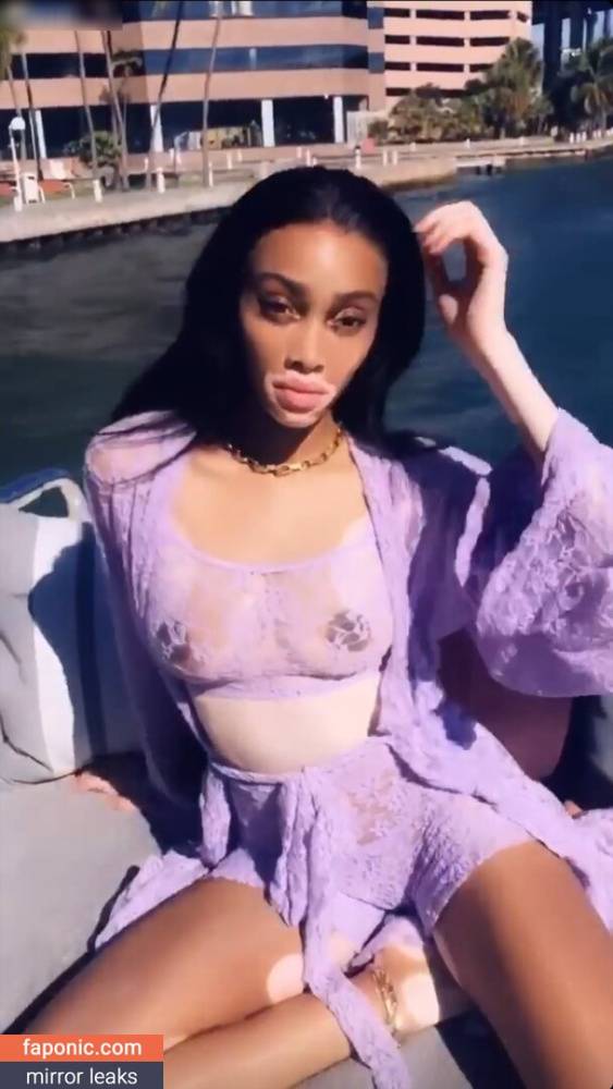 Winnie Harlow aka winnieharlow Nude Leaks - #9