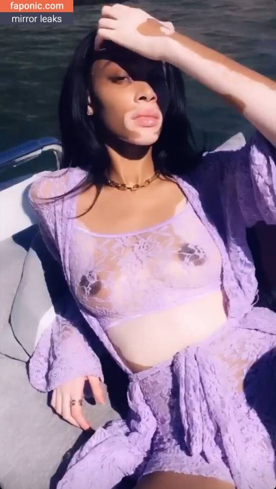 Winnie Harlow aka winnieharlow Nude Leaks - #13