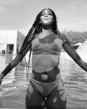 Winnie Harlow / winnieharlow Nude Leaks - Fapello - #16