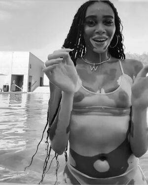 Winnie Harlow / winnieharlow Nude Leaks - Fapello - #17