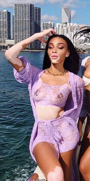 Winnie Harlow / winnieharlow Nude Leaks - Fapello - #28