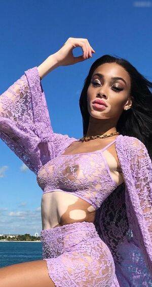 Winnie Harlow / winnieharlow Nude Leaks - Fapello - #23