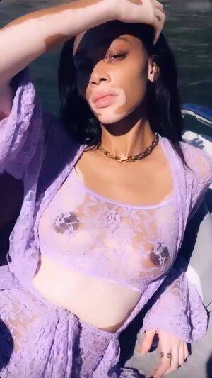 Winnie Harlow / winnieharlow Nude Leaks - Fapello - #30