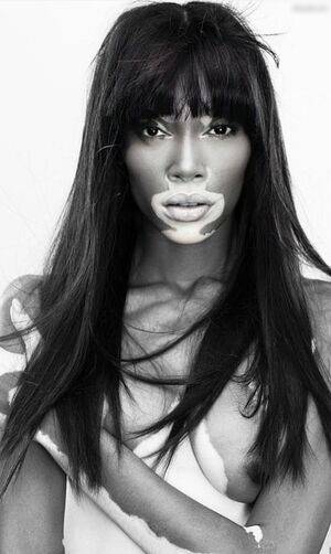 Winnie Harlow / winnieharlow Nude Leaks - Fapello - #14